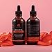 Margano Rosehip Seed Oil | 100% Natural & Organic, Cold Pressed Rosehip Oil For Face, Skin, Hair & Nails | Anti-Aging, Wrinkles, Acne, Scar & Discoloration Facial Oils Treatment | 4oz