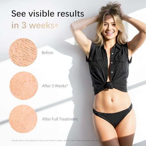 Haarlosy IPL Devices Hair Removal Laser for Men and Women - 10°C Ice Cooling Contact at Home for Painless and Long-Lasting Results, 86% Hair Reduction in 3 Weeks for Body, Legs, Bikini