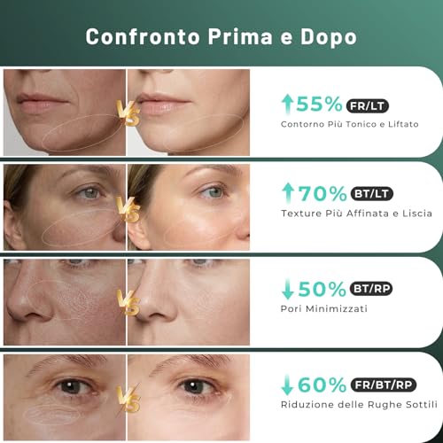 Professional Radiofrequency Face Massager, Microcurrent Facial Massager, Electric Beauty Device Anti-Wrinkles, Anti-Aging, Anti-Acne, Lifting and Firming for Face and Neck (Green)