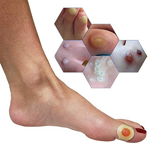 Corn Remover,Foot Corn Remover Pads, Corn Callus Remover Cushions,Corn Plaster with Hole,Corn Remover Pads for Foot Corn Removal Reduces Pain,24 Pads - Thumbnail 4