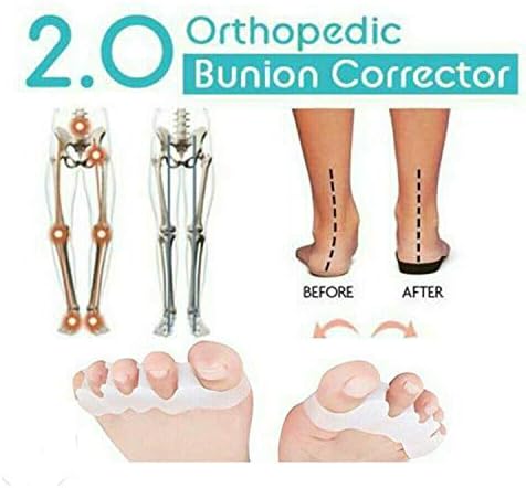 2019 Orthopedic Bunion Corrector 2.0 (1 Pair)