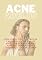 Livro ACNE:ADULTO: Descubra como controlar e reduzir a acne na fase adulta de forma eficaz e natural (Superalimentos para a Saúde)