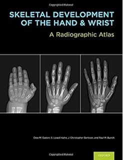 atlas de greulich et pyle pdf