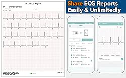 EMAY Portable ECG Monitor | Record ECG and Heart