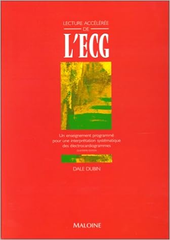 Amazon Fr Lecture Acceleree De L Ecg 4e Edition Dubin D Livres Amazon Fr Lecture Acceleree De L Ecg 4e Edition Dubin D Livres