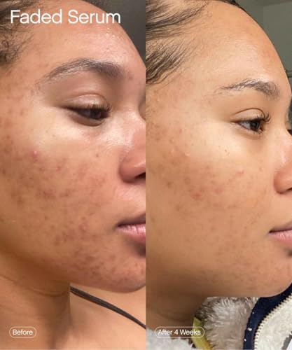 Topicals Faded Brightening and Clearing Serum | Reduces Discoloration Post-Blemish Marks Scars Spots Contains Kojic Acid Niacinamide Dermatologist-tested Vegan Cruelty-Free Fl Oz