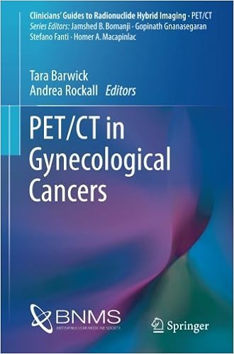 Httpybookgfssgablogsebook Torrents Tc3a9lc3 - 