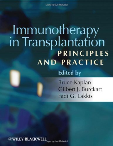 Immunotherapy in Transplantation - Principles and Practice