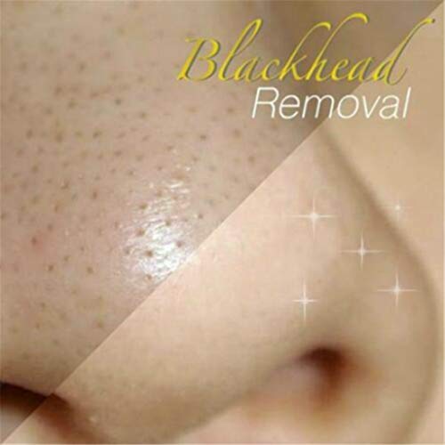 Elaco 24k Gold Collagen Peel-off Facial Mask with 5PC Face Mask Sheet Whitening Anti-Wrinkle Skin Care Face Lifting Firming Moisturize Anti-Aging Repair Skin Reduces Wrinkles Fine Lines & Acne Scar