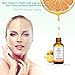 Natural 20% Vitamin C Serum Hyaluronic Acid for Face Vitamin C Skin Brightening Serum Dark Spot Remover and Anti Wrinkle Serum Reduce Age Spots and Sun Damage