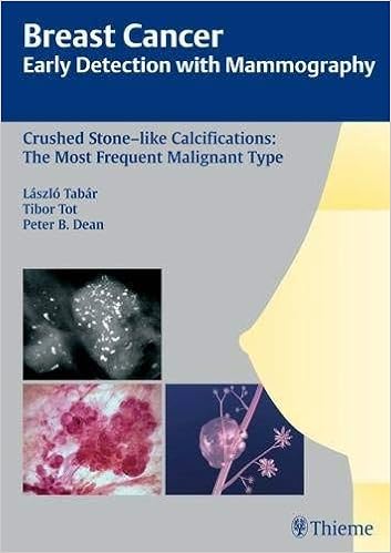 Breast Cancer Early Detection With Mammography Crushed Stone Like Calcifications The Most Frequent Malignant Type 9783131485311 Medicine Health Science Books Amazon Com
