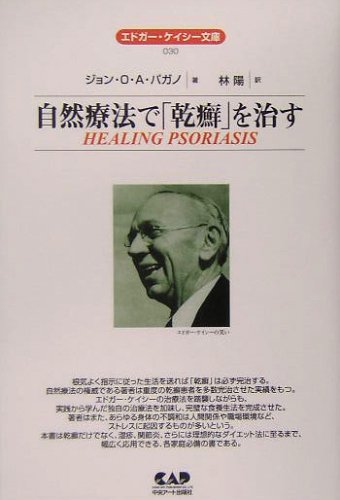 自然療法で 乾癬 を治す エドガー ケイシー文庫 John O A Pagano Amazon Com Books