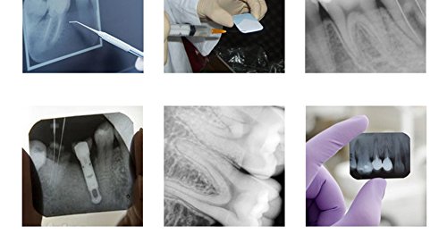 Dental Xray Film Imaging Processor Darkroom Portable Developer for Periapical X Ray Ideal - Thumbnail 6