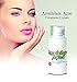 Annihilate Acne Cream - for Acne, Skin, PCOS, Hormonal Balance, Libido, Energy and Menopause with DIM, Progesterone, and Salicylic Acid.