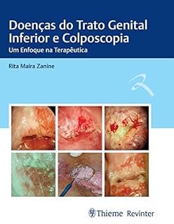 Livro Doenças do Trato Genital Inferior e Colposcopia: Um Enfoque na Terapêutica