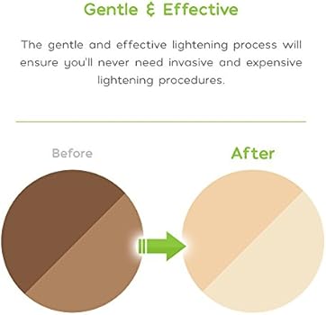 inner thigh bleaching