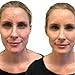 Full Coverage Concealer Palette, Waterproof Concealer Cream, 3 Colors + Brush, by Dermaflage