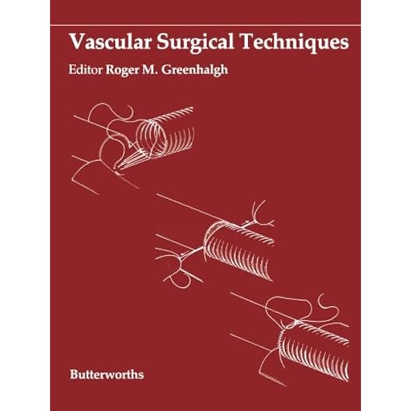 Amazon.com: Vitreous Microsurgery: 9781608315031: Charles MD