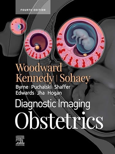 Amazon.com: A Practical Guide to Fetal Echocardiography: Normal