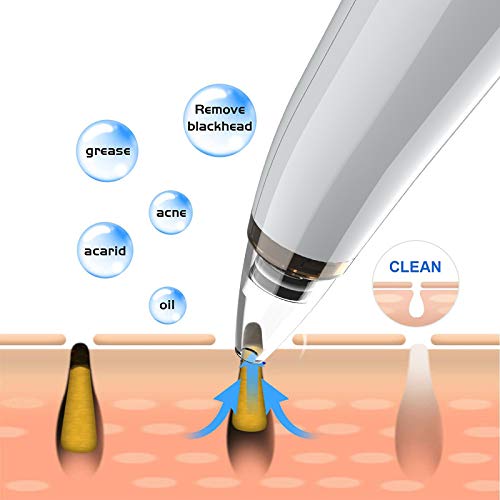 Blackhead Remover Pore Vacuum Facial Cleaner Electric Acne Extractor USB Rechargeable Comedo Removal Beauty Device with… - Image 2
