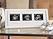 Pearhead Pregnancy Trimester Sonogram Frame, Ultrasound Picture Frame, Pregnancy Milestone Keepsake Photo Frame, Sonogram Keepsake, Gender-Neutral Baby Nursery Décor, 1st 2nd and 3rd Trimester, White