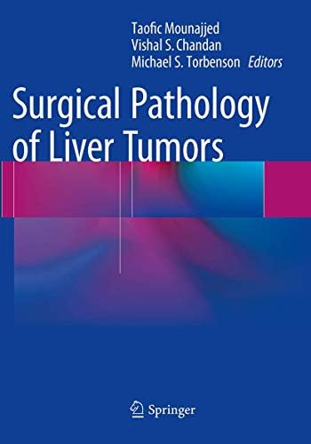 肝臓病理学『MacSween's Pathology of the Liver』 MacSween's Pathology of the Liver: 9780702082283: Medicine