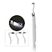 (USA SHIPPIN) HONEWIN 3 in 1 LED Oral Dental Hygeine Professional Cleaning Tool Kits Sonic Tooth Stain Eraser Plaque Remover,Teeth Burnisher Polisher Whitening Tartar Plaque Remove Surface
