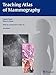 Teaching Atlas of Mammography (RÖFO-Ergänzungsbände) by