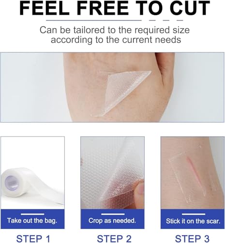 Silicone Scar Removal Sheets (1.6''x 120'', 3M), Professional Upgrade Silicone Sheet for Scars Caused by C-Section, Surgery, Burn, Acne, Stretch Marks, Works on Old & New Scars, Reusable Scar Sheets