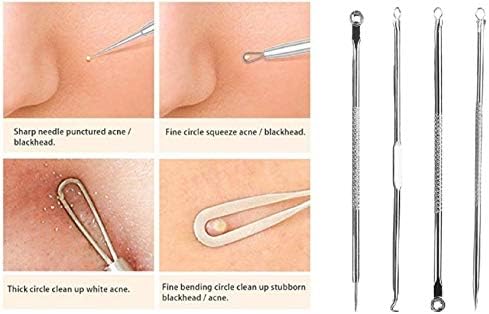 Wizme Set Of 4 Professional Stainless Steel Blackhead Pimple Blemish Extractor Remover Tool Skin Clean Care Kit For Men And Women (20 Grams) Pack Of 1