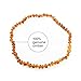 Amber Teething Necklace – Polished Teething Necklace For Babies Unisex (Honey) – Anti-inflammatory, Swollen gums & Teething Pain Reduce Properties – Certificated Natural Ukrainian Amber Beads