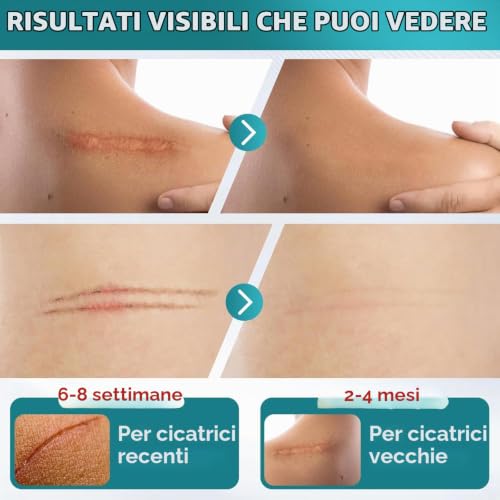 Silicone Scarring Sheets, Silicone Scars Plasters, 4 cm x 300 cm | Custom cut, everyday comfort and easy application
