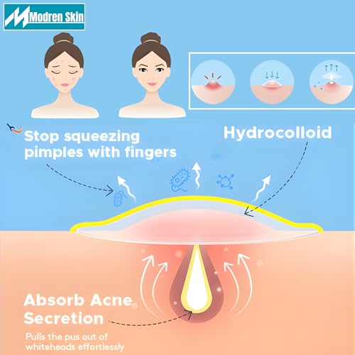 MODREN SKIN – 144 Pcs Pimple patches 4 Sheets – Hydrocolloid pimple patch with easy peel off cut lines in a resealable zipper bag – Acne Patch dots (Small 8mm, Medium 10mm)