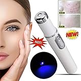 2018 Powerful Anti-varicose Veins Face Acne Removal Pen