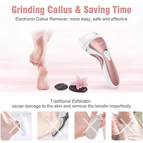 Ovonni Electric Callus Remover, Professional Powerful Rechargeable Foot File for Feet, Portable Cordless Waterproof Callus Shaver with 3 Roller Heads for Dead Hard & Cracked Dry Skin (Gold)