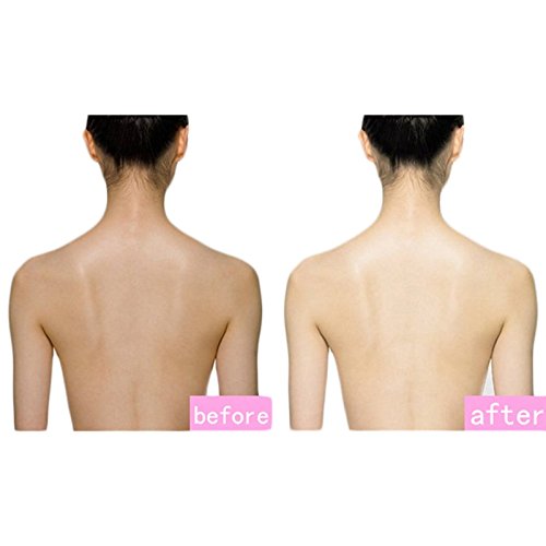 back neck whitening cream