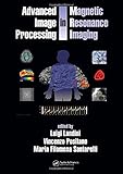 Advanced Image Processing in Magnetic Resonance Imaging (Signal Processing and Communications)