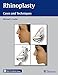Rhinoplasty: Cases and Techniques