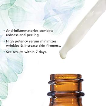 best retinol serum for hyperpigmentation