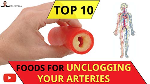 [R.e.a.d] Top Ten Foods That Unclog Your Arteries Naturally [W.O.R.D]