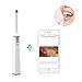 Wireless Dental Intraoral Camera, ScopeAround WiFi Fit Smart Clear Dental Personal Care Camera for iPhone iPad Samsung LG SONY Mac and PC