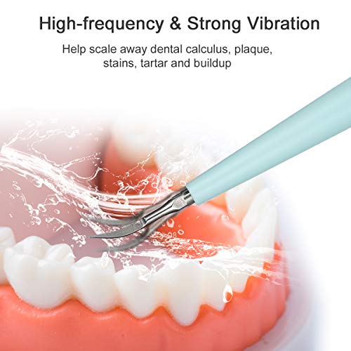 Dental Tools Electric Dental Calculus Remover Tartar Remover for Teeth Cleaning Kit for Home Use(Blue)
