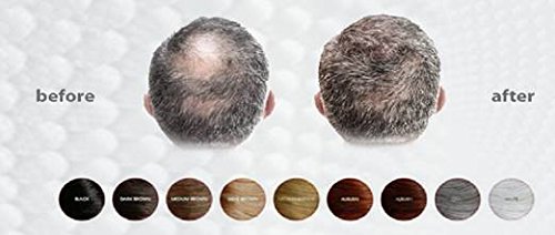 LUXE Hair Thickening Fibers with Natural Keratin-2 Months+ Supply!-Confidence in a Jar!-Multiple Colors Available (Light Brown)