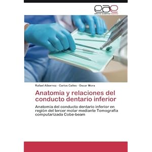 Anatomía y relaciones del conducto dentario inferior: Anatomía del conducto dentario inferior en región del tercer molar mediante Tomografía compu