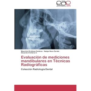 Evaluación de mediciones mandibulares en Técnicas Radiográficas: Colección Radiología Dental (Spanish Edition)