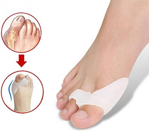 Bunion Corrector - Hammer Toe - 2 pcs Silicone Toe Bunion Hallux Valgus Feet Care Regulator Finger Toes Thumb Hole Protectors Top Quality - Correct Toes
