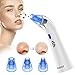 Blackhead Remover, Beakmil Electric Blackhead Vacuum Suction Remover, Skin Facial Pore Cleaner, Acne Comedone Extractor Tool Set, Comedo Exfoliating Machine with 5 Adjustable Suction