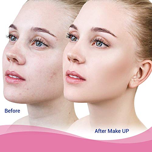 OHeal Acne Pimple Master Patch 108 dots - Absorbing Hydrocolloid Blemish Spot Skin Treatment (108 Patches, 3Pack)