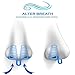 Nose Vents - Snore Stopper Nose Vents - Stop Snoring Nasal Vents - Anti Snoring Devices - Snoring Solution - Anti Snoring Nasal Dilator - Reusable Nose Plugs - Anti Snoring aids