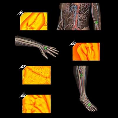 Buy Denshine Vein Finder Vein Display Lights Imaging Find Vein Medical Vein Finder For Adults Children On Various Skin Help Nurses Caregivers And Medical Students Online In Vietnam B07sv5pcr9